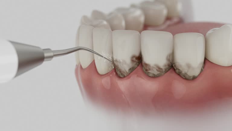 Reliable Dental Implants contractor in Buckner, KY by Smile Center Dentistry